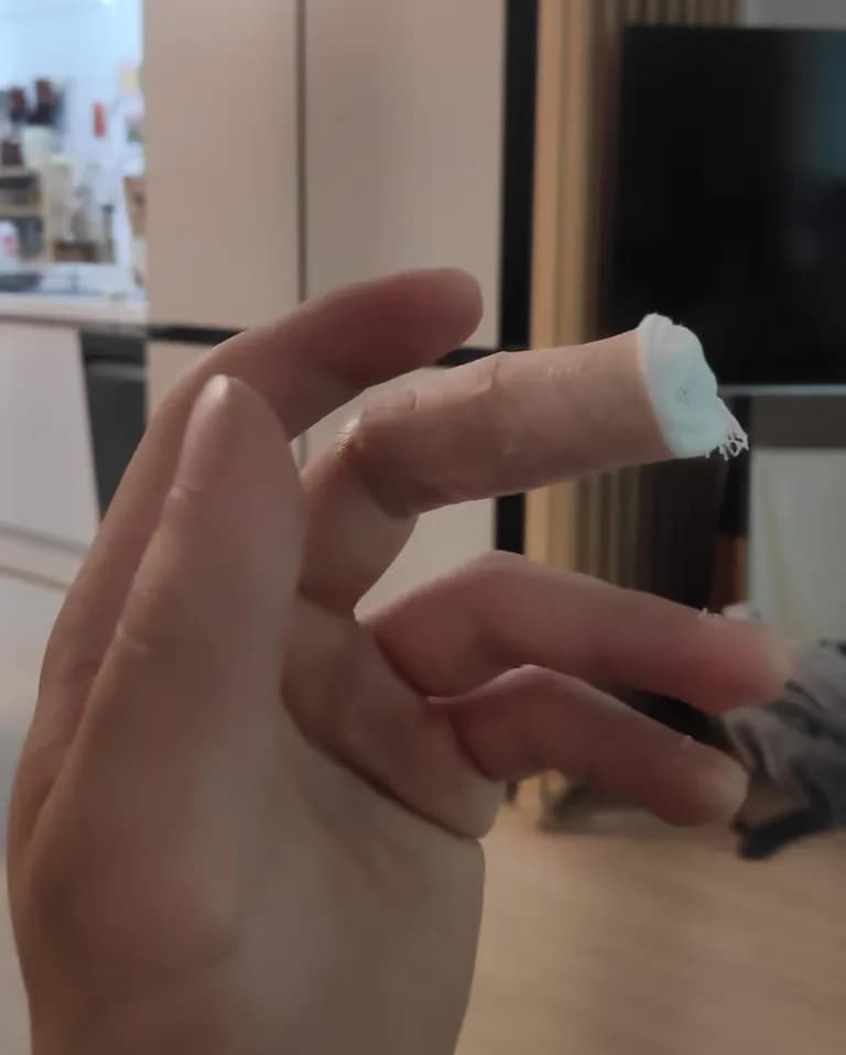 Tiempo de recuperación de una herida cortante-1