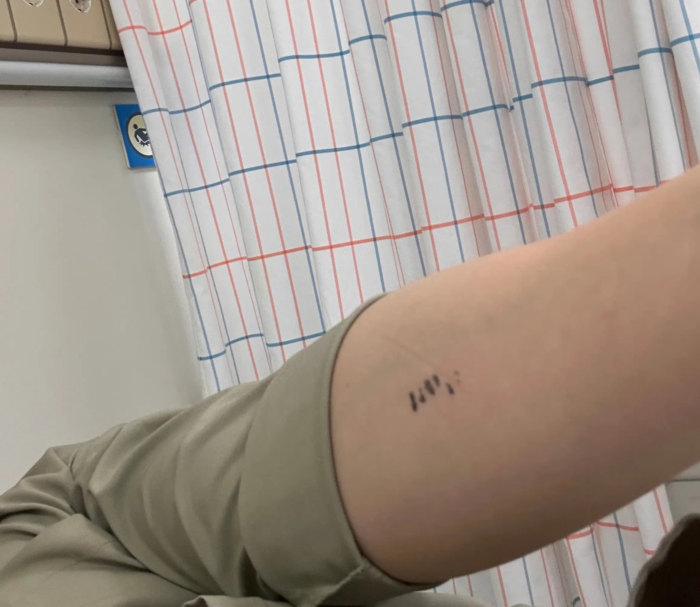 サンゲ・ベク病院救急外来の口コミ - 縫合の基準、ドレッシングの方法、縫った傷の回復期間-10