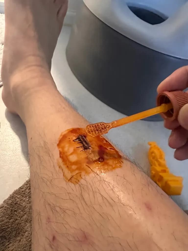 サンゲ・ベク病院救急外来の口コミ - 縫合の基準、ドレッシングの方法、縫った傷の回復期間-16