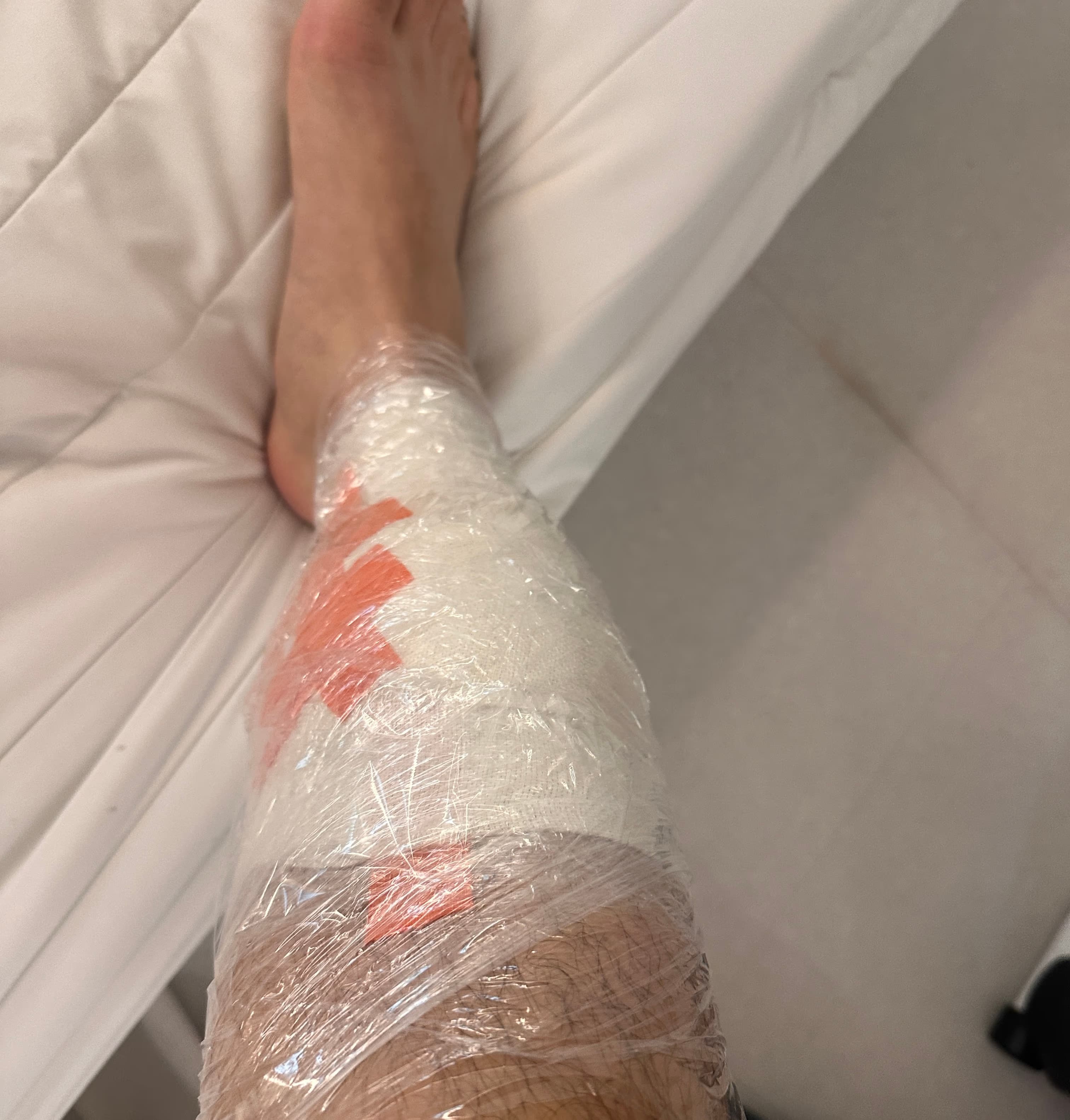 상계 백병원 응급실 후기 - 상처 꿰매는 기준, 드레싱 방법, 꿰맨 상처 회복 기간-12