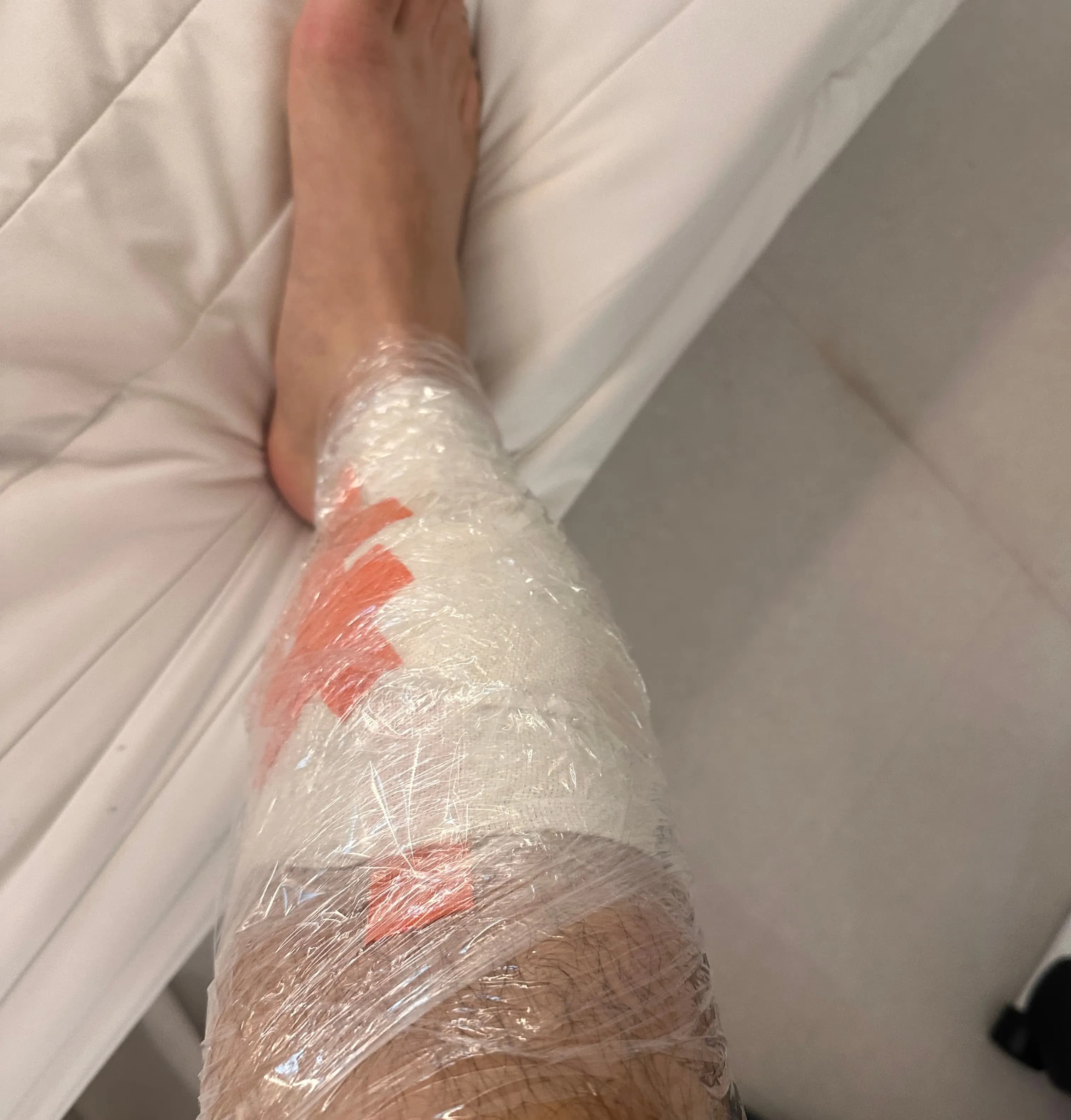 サンゲ・ベク病院救急外来の口コミ - 縫合の基準、ドレッシングの方法、縫った傷の回復期間-12