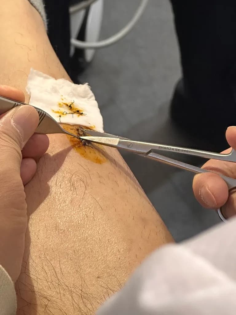 상계 백병원 응급실 후기 - 상처 꿰매는 기준, 드레싱 방법, 꿰맨 상처 회복 기간-18