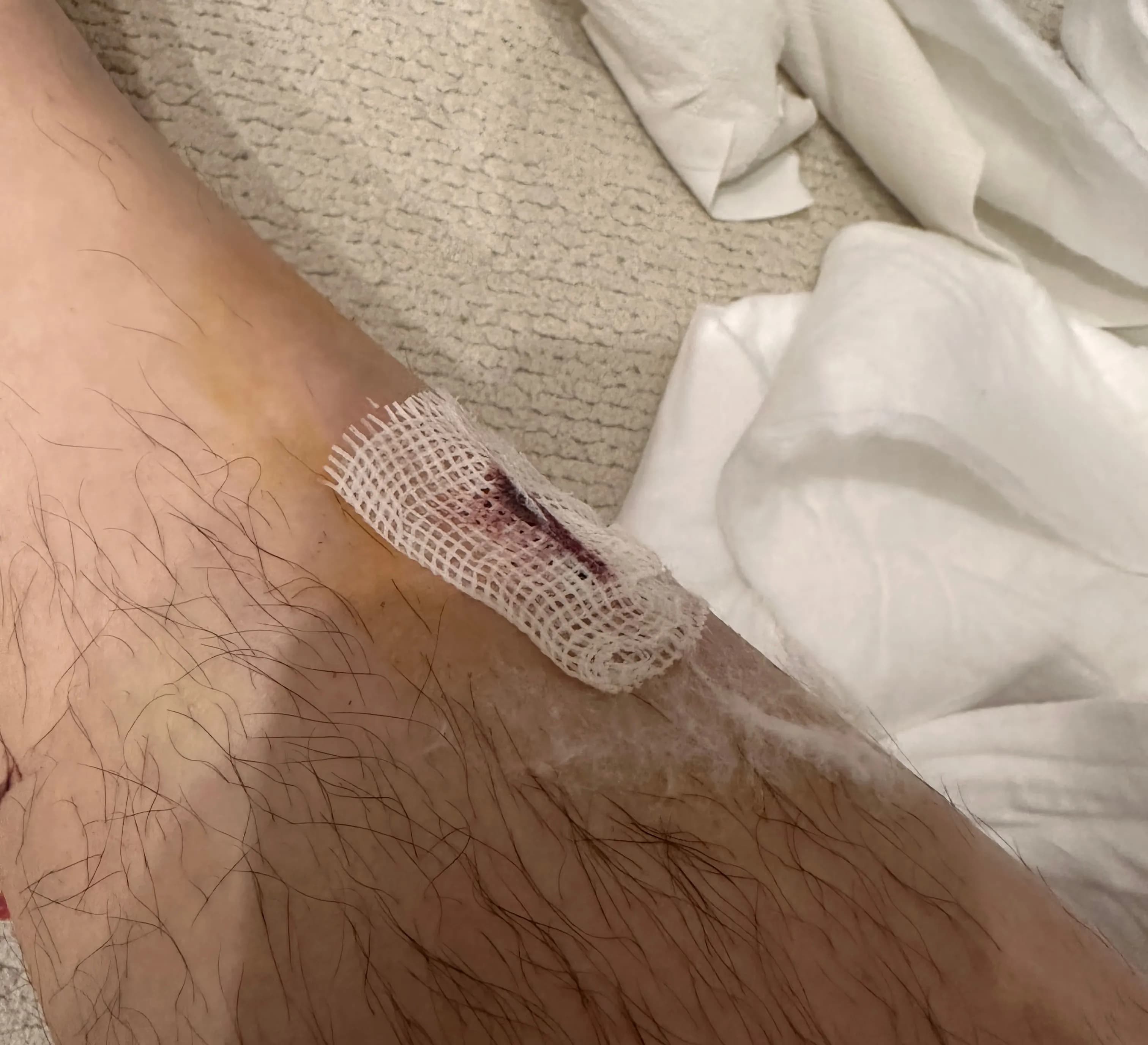 サンゲ・ベク病院救急外来の口コミ - 縫合の基準、ドレッシングの方法、縫った傷の回復期間-11