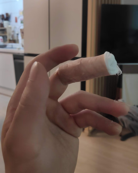 상계 백병원 응급실 후기 - 상처 꿰매는 기준, 드레싱 방법, 꿰맨 상처 회복 기간-13